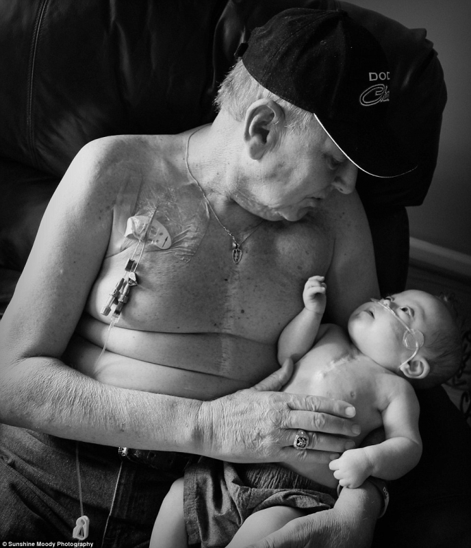 Фото дедушки и внука с шрамами на груди растрогало пользователей Интернета (ФОТО)