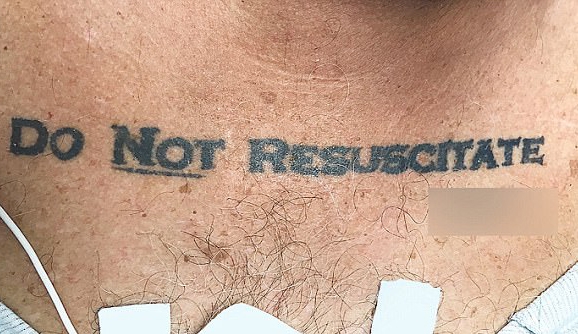 Врачи не стали реанимировать 70-летнего пациента из-за татуировки