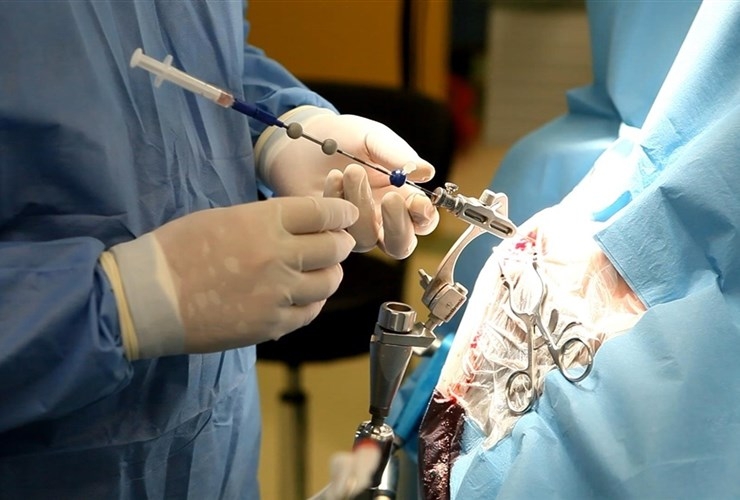 Украинские врачи первыми в мире провели сложную операцию (ВИДЕО)