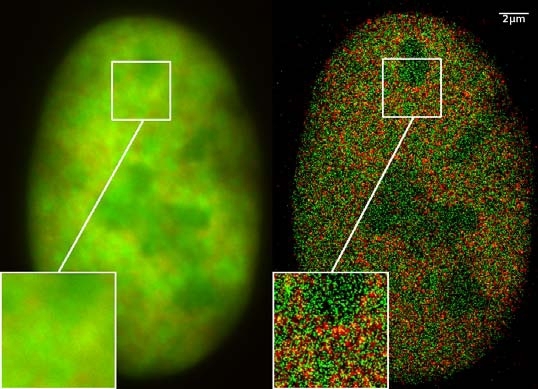 Нобелевскую премию по химии вручили за флуоресцентную микроскопию