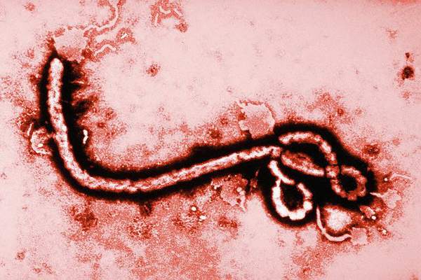 В Европе всерьез обеспокоились лихорадкой Эбола