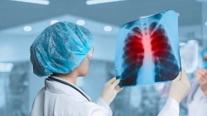 Как диагностировать туберкулез