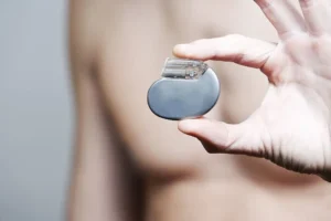 Кардіостимулятор