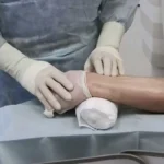 Коронографія