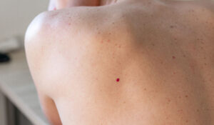 новообразование