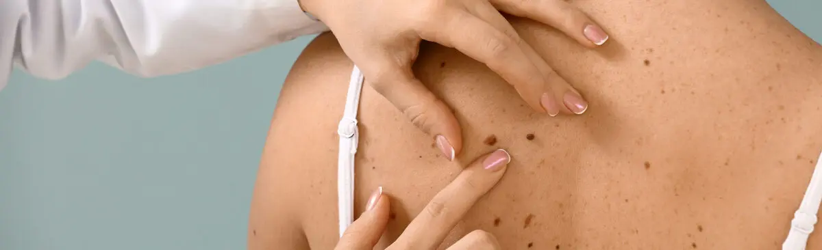 Как выглядит базальноклеточная карцинома