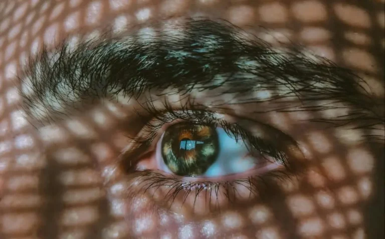 Искры перед галазами