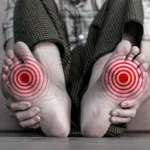 Нейропатія