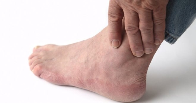 О каких болезнях расскажут отеки ног?