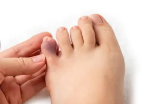 Пальці стопи