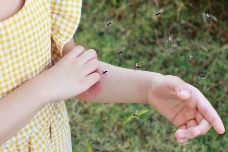комары на руке