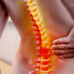 Спінальний стеноз