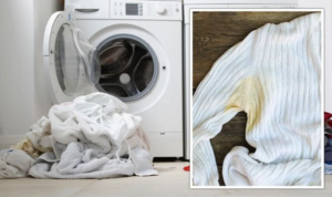 желтые пятна