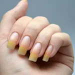Жовтіють нігті